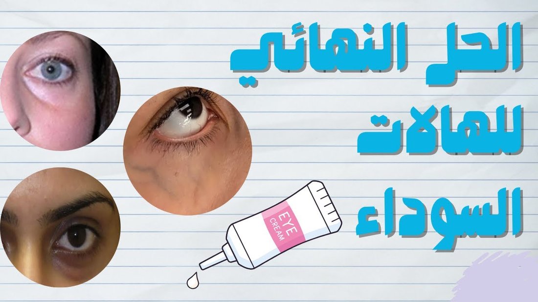 كيفية علاج الهالات السوداء تحت العين نهائياً بوصفات منزلية مجربة