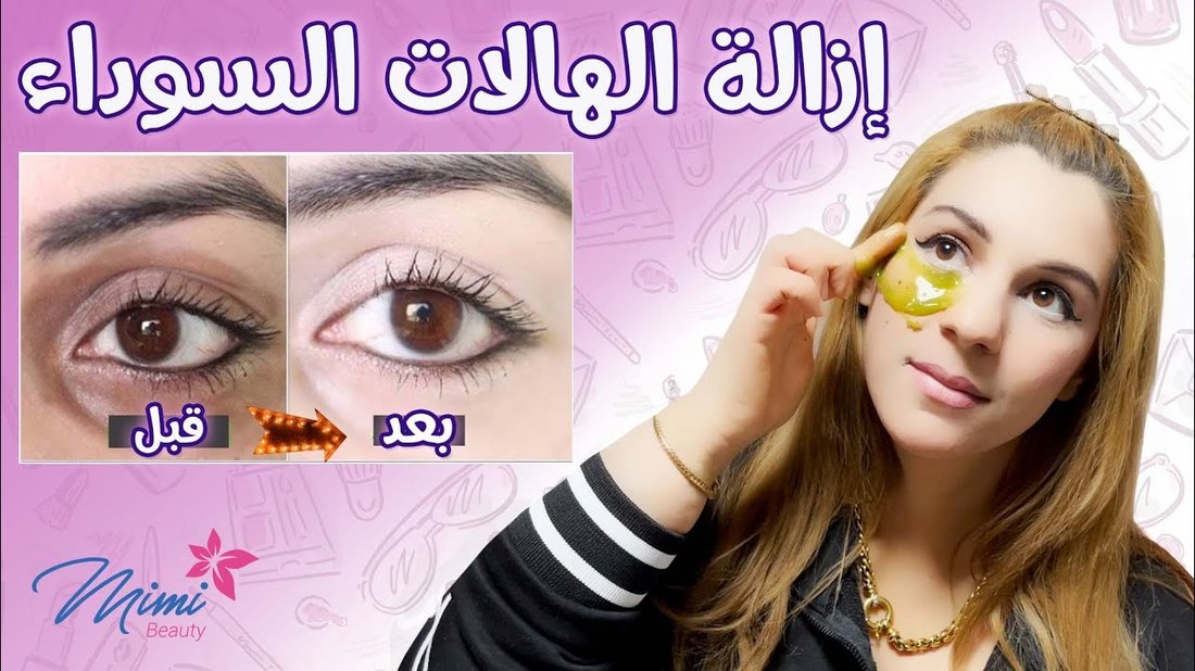 أسباب السواد تحت العين وطرق علاجها النهائية بالماسكات الطبيعية